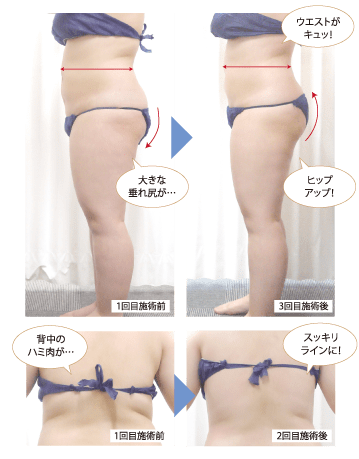ウエストがきゅっ、ヒップアップ!
