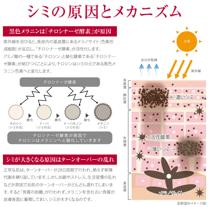 シミの原因とメカニズム